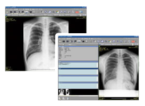 画像診断装置ワークステーション